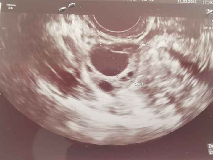 Chi non le aspetta per Aprile 2022 💓🍀🤞🏼 - 1
