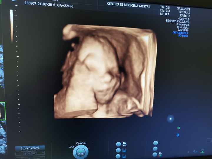 Future mamme marzo 2022 - 1