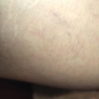 Problemi con la pillola: confrontiamoci - 1