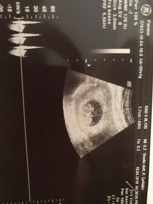 Future mamme di novembre 2