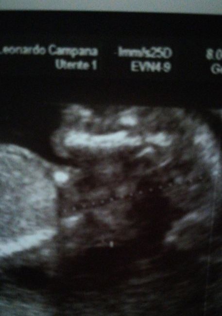 Future mamme "dicembrine" 2019 💙💗 1