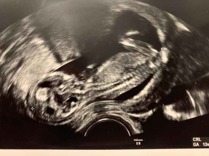 Mamme di Agosto 2019 - 1