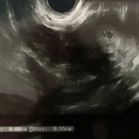 Prima eco😍😍 - 1