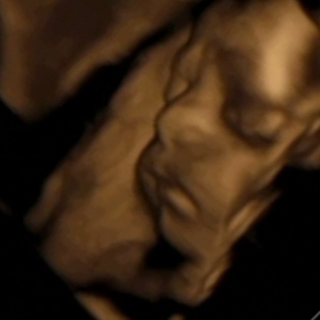 Future mamme di Aprile 2021 🐣 - 1