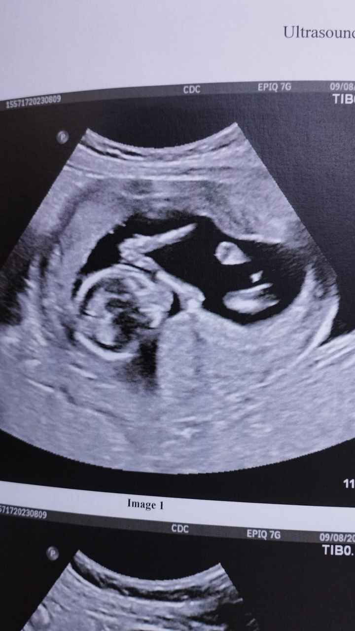 Future mamme febbraio 2024🍀💚 - 1