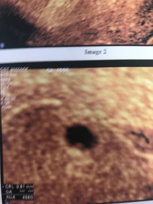 Future mamme di febbraio 2022 - 1