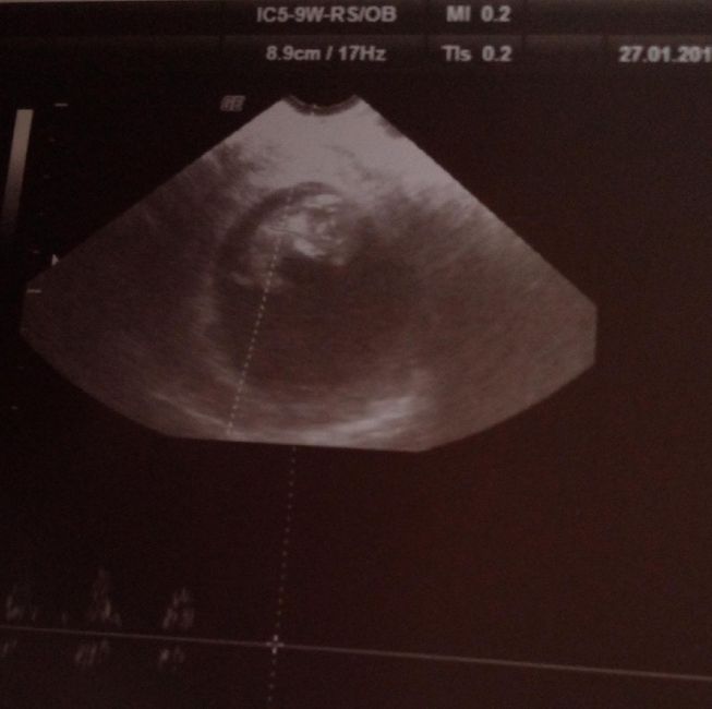 Due domandine 😜 6