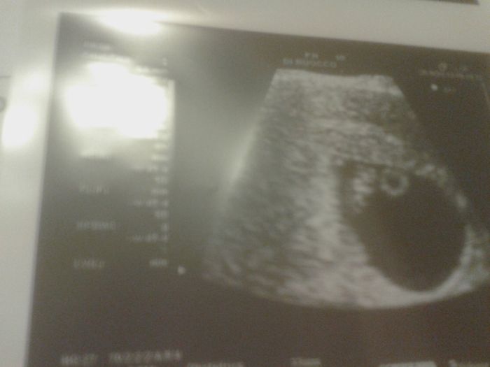 Come si fa a non avere paura??? Consigli!!! - 1