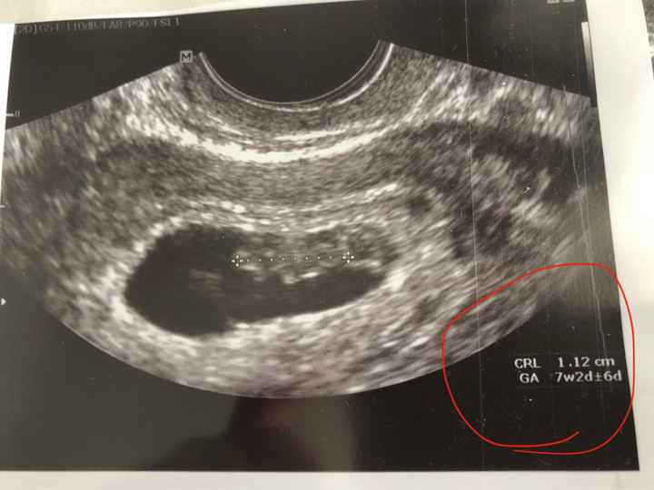 Future mamme novembre 2020 🌞🍁🌷♾ - 1