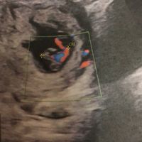 Metodo Ramzi eco 10+1 - 1