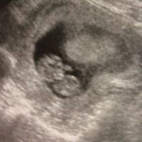 Metodo Ramzi eco 10+1 - 1