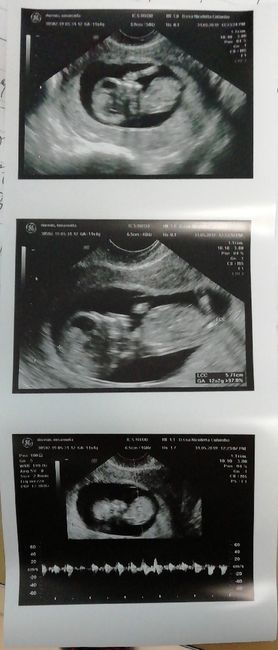 Future mamme "dicembrine" 2019 💙💗 - 1