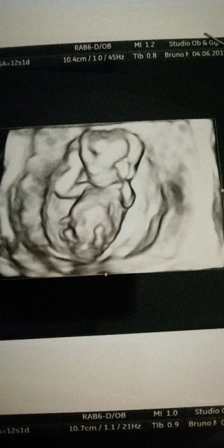 Future mamme "dicembrine" 2019 💙💗 - 1