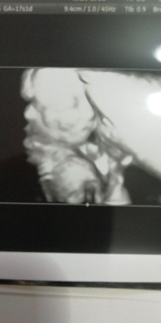 Future mamme "dicembrine" 2019 💙💗 - 2
