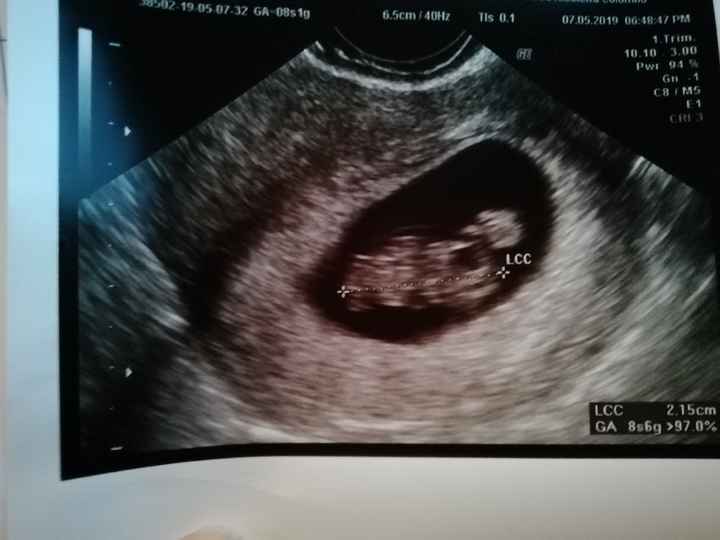 Metodo Ramzi... chi mi aiuta?! - 1