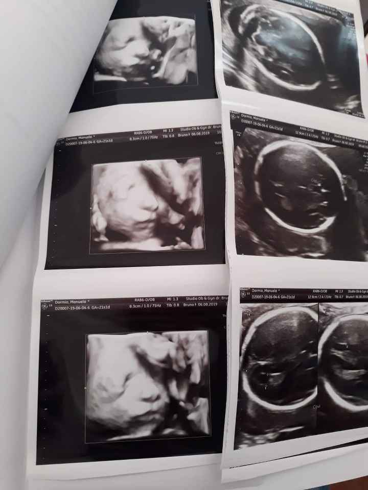 Future mamme "dicembrine" 2019 💙💗 - 1