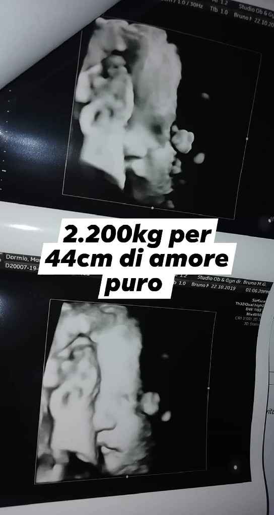 Future mamme "dicembrine" 2019 💙💗 - 1