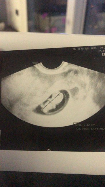 Future mamme novembre 2020 🌞🍁🌷♾ - 1