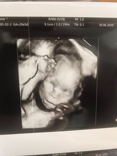 Future mamme novembre 2020 🌞🍁🌷♾ - 1