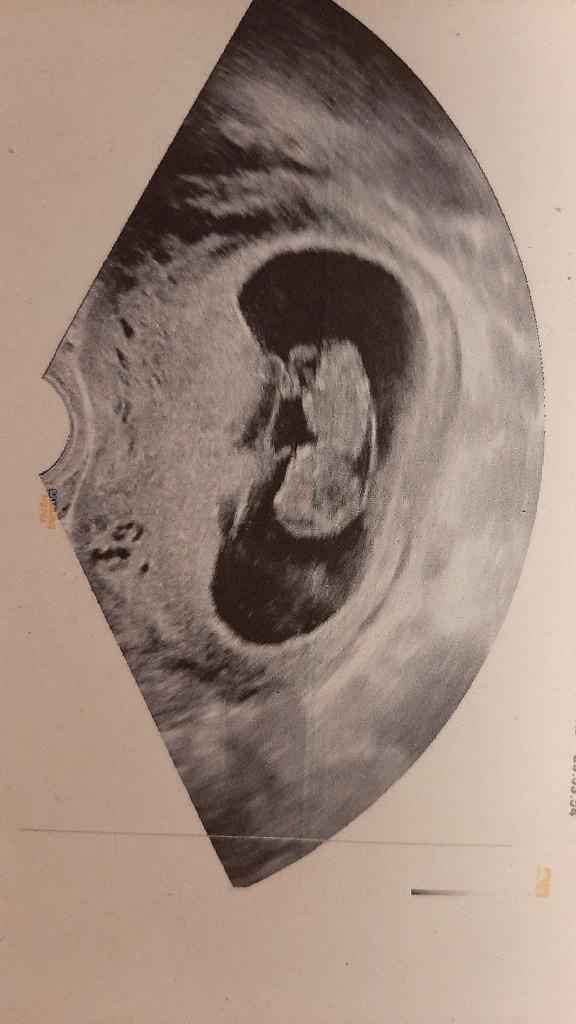 Metodo Ramzi pareri 3