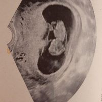 Metodo Ramzi pareri - 1