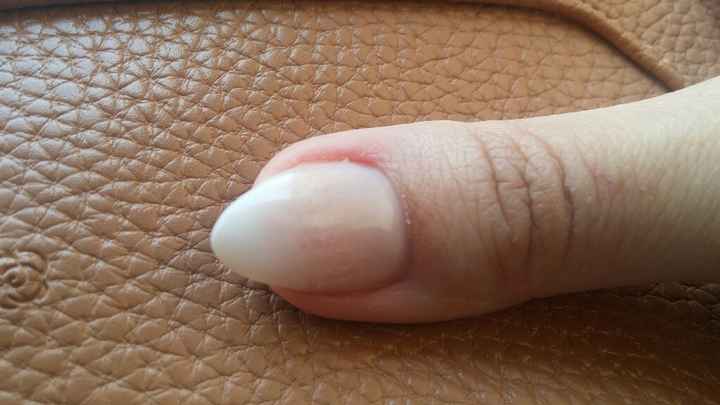 Dopodomani mi sposo e ho le unghie rovinate - 1