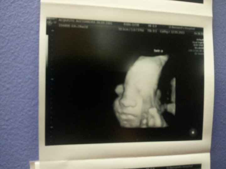 baby twin boy 28 weeks