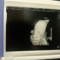 baby twin boy 28 weeks