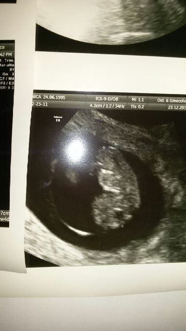 Ogni quanto fate ecografie ? - 1