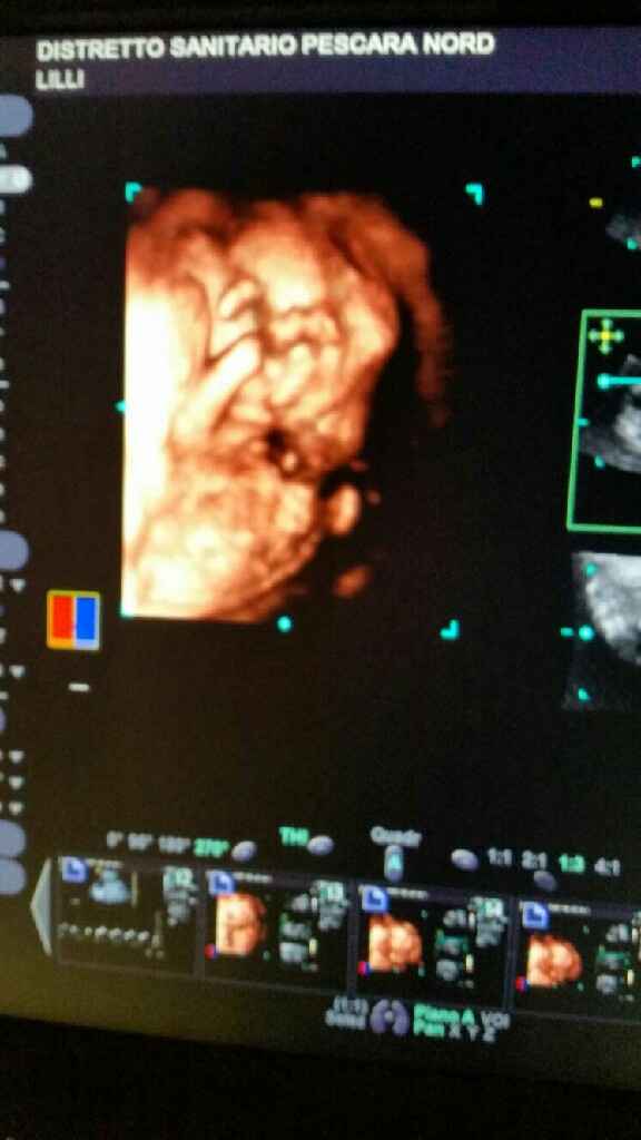 Morfologica! femminaaaaaa - 1