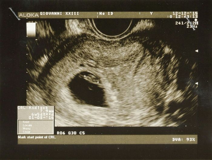 Neo spose 2015 all'appello!! - 1