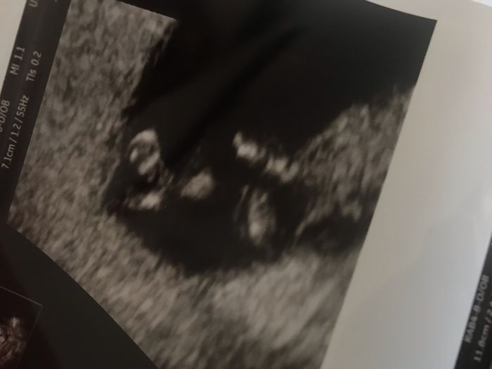 Future mamme di novembre 1