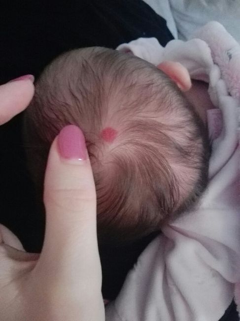 Macchia in testa - 1