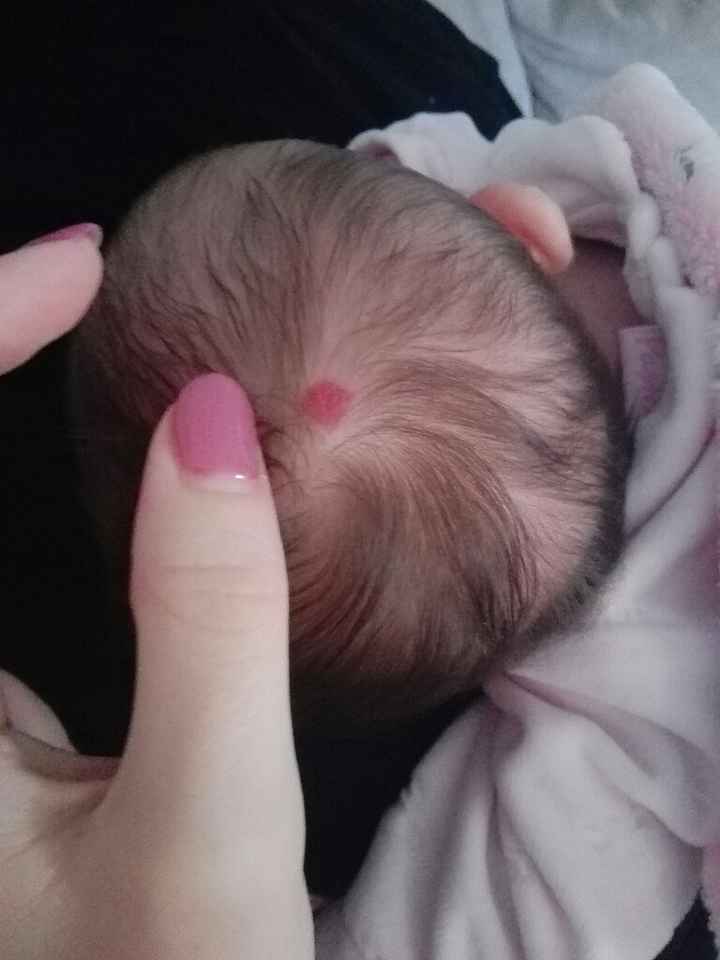 Macchia in testa - 1