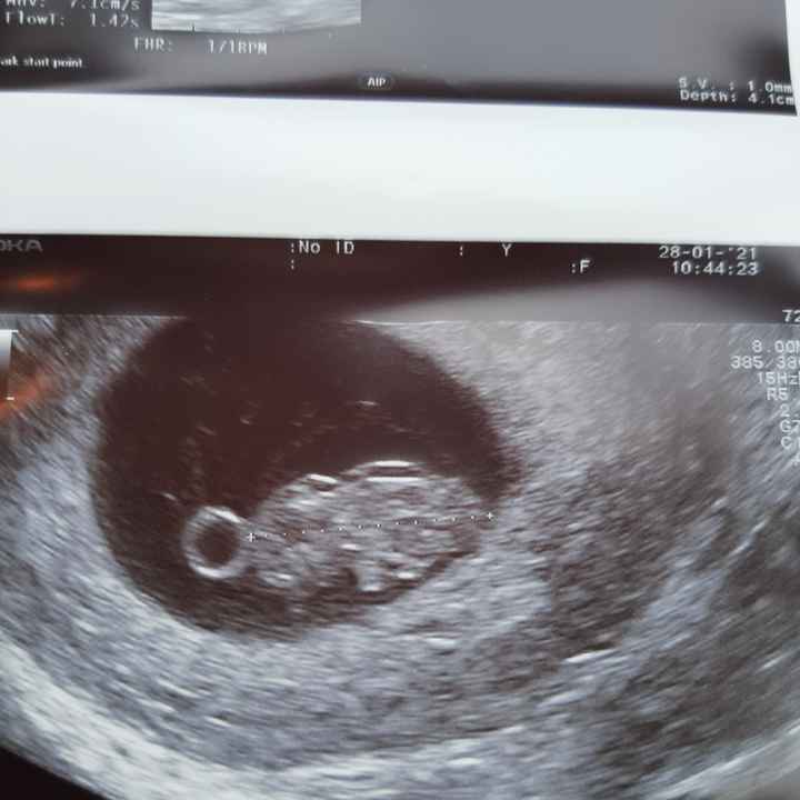 Future Mamme Settembre 2021😍 - 1