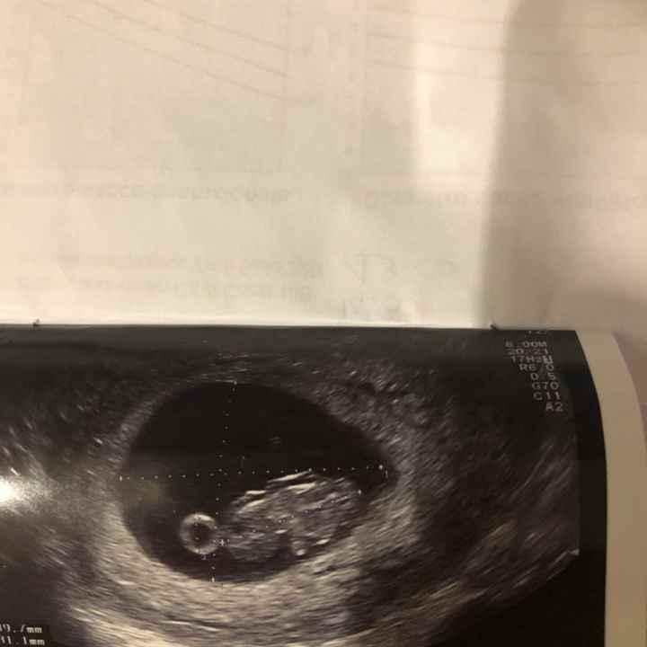 Future Mamme Settembre 2021😍 - 1