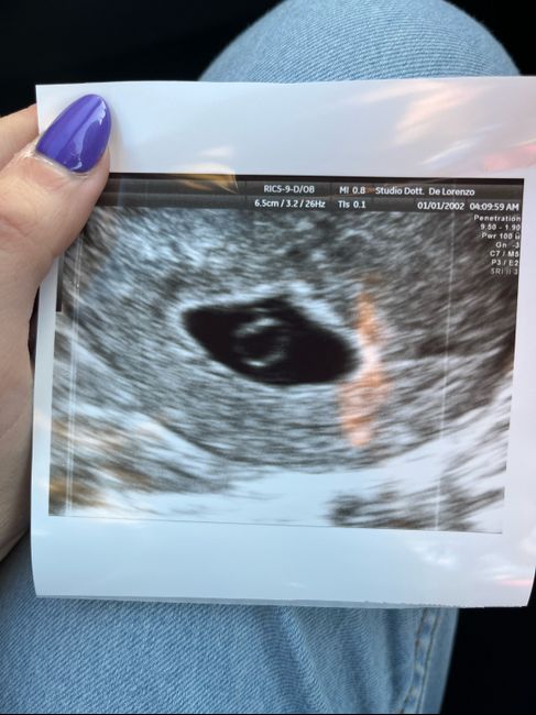 Future mamme Dicembre 2023 - 1