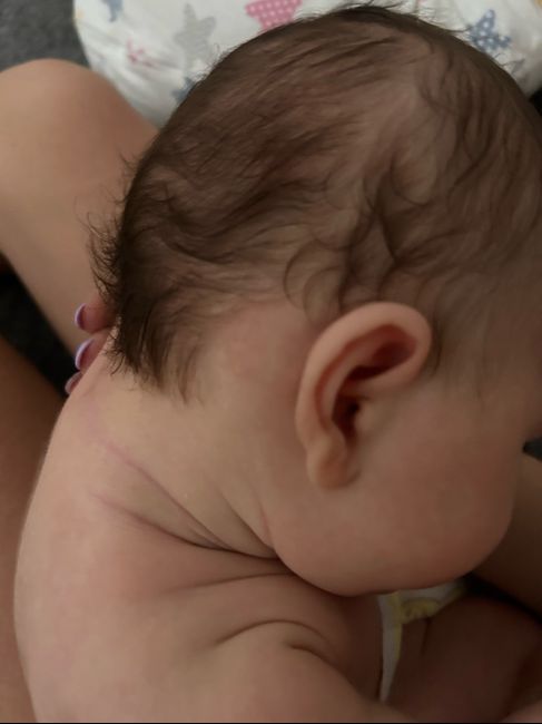 Pallina dietro l’orecchio bimbo 1