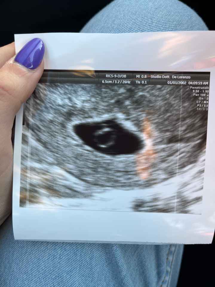 Esperienze uovo bianco 2