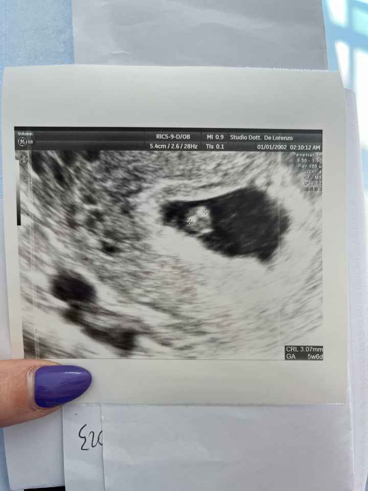 Future mamme Dicembre 2023 - 1