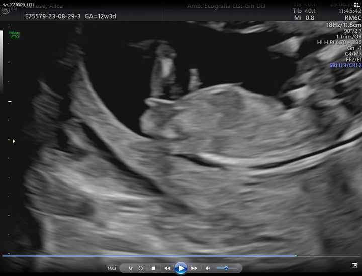 Future mamme di Marzo 2024 - 1