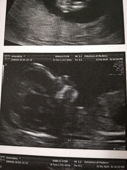 Mamme di Agosto 2020😍🤞😍 - 1