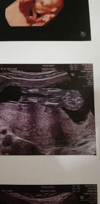 Mamme di Agosto 2020😍🤞😍 - 1