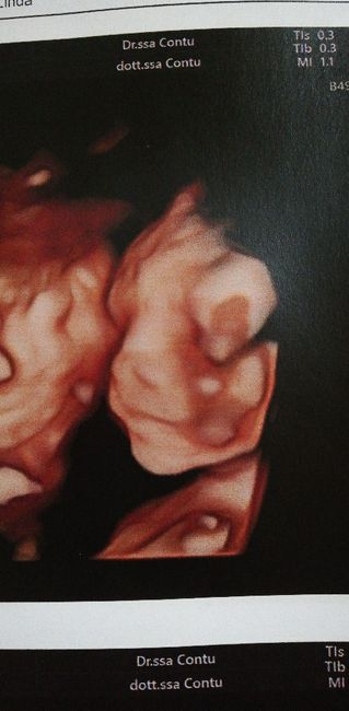 Mamme di Agosto 2020😍🤞😍 - 1