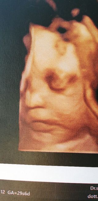 Mamme di Agosto 2020😍🤞😍 - 1