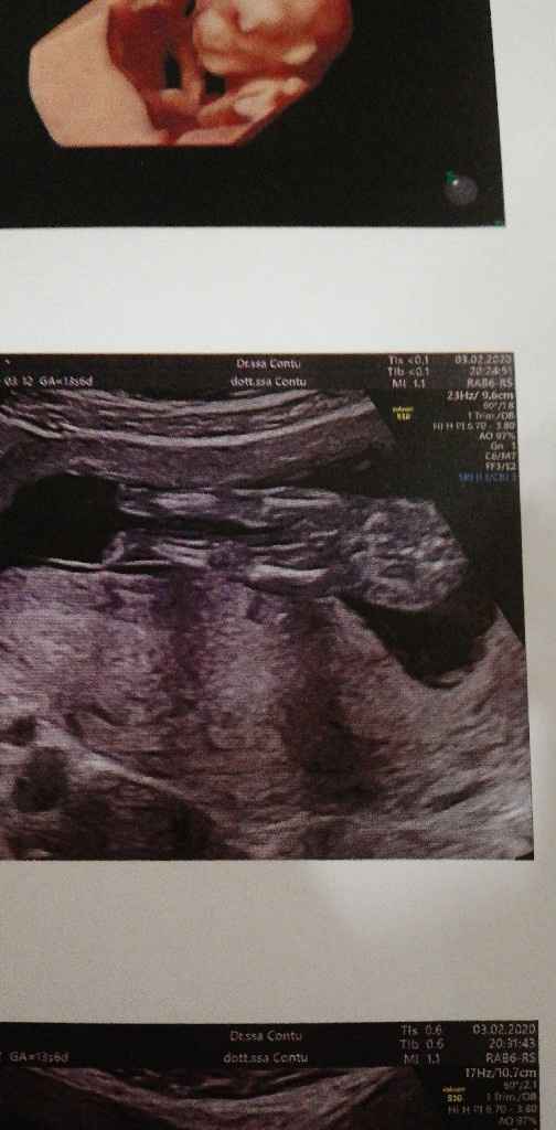 Mamme di Agosto 2020😍🤞😍 - 1