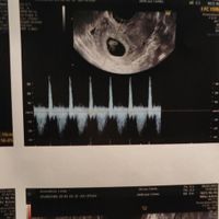 Future mamme settembre 2023😍🎉🌈 - 1