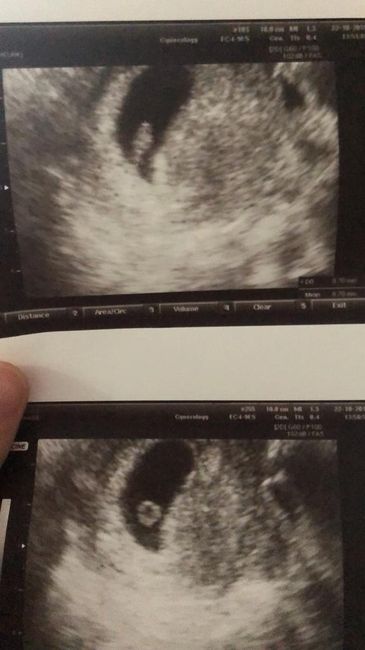 Future Mamme Giugno 2020 - 1