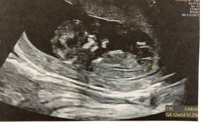 Future mamme ottobre 2022 - 1