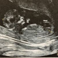 Future mamme ottobre 2022 - 1